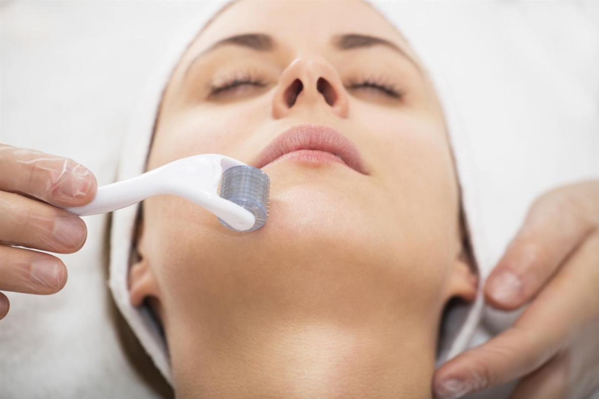 Microneedling: A Game-Changer for Business Professionals Seeking Skin Perfection