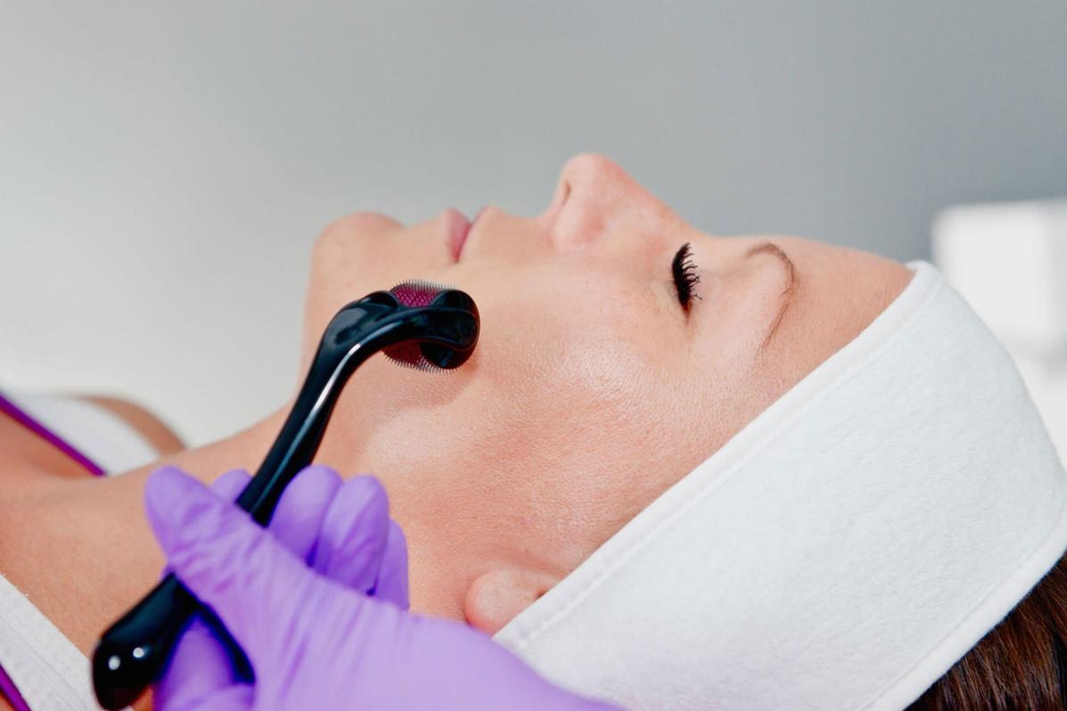 What is the Aftercare for Microneedling Collagen Induction Therapy?