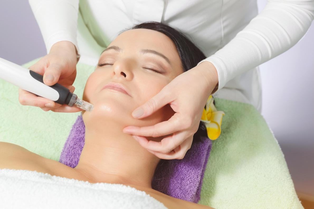 Microneedling for Acne Scars: Can It Really Help?